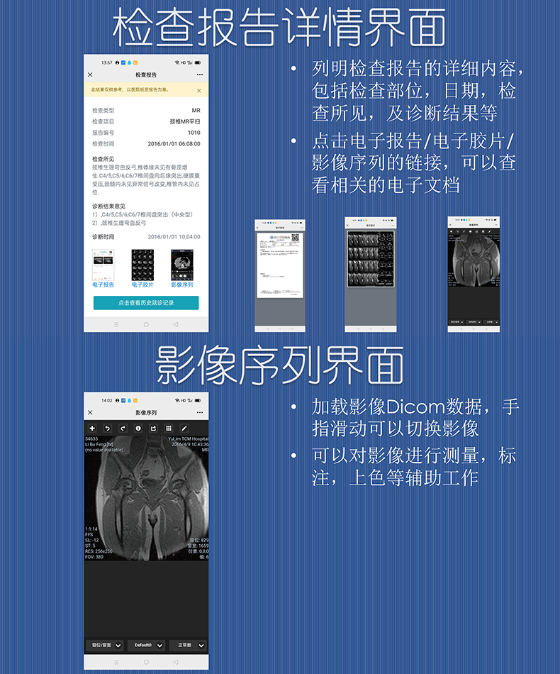 醫院放射透視檢測報告電子膠片檢查報告云管理系統軟件開發APP小程序定制